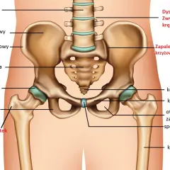 Anatomia miednicy z zaznaczonymi strukturami, które mogą powodować ból stawów, np. zapalenie kaletek, przeciążenie ścięgien, zapalenie stawu krzyżowo-biodrowego.