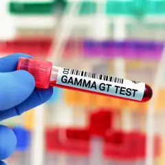Rękawiczka w niebieskiej rękawiczce trzyma probówkę z napisem "GAMMA GT TEST". W tle widać inne probówki z próbkami.