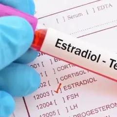 Kiedy badać estradiol? Klucz do wiarygodnych wyników!