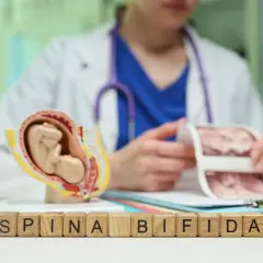 Model płodu i kostki z napisem "SPINA BIFIDA" symbolizują wady rozwojowe kręgosłupa.