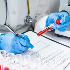 Lekarz w niebieskich rękawiczkach analizuje wyniki badań, trzymając probówkę z krwią. Obok leży stetoskop i mikroskop, a na stole formularz z danymi pacjenta, który czeka na swój jonogram.