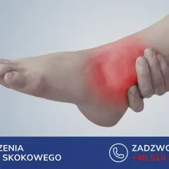 Ból w okolicy stawu skokowego, gdzie znajduje się kość strzałkowa. Czerwony obszar wskazuje na stan zapalny.