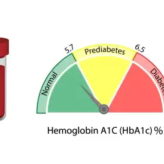 Wskaźnik HBA1C co to za badanie: probówka krwi i wykres pokazujący normę, stan przedcukrzycowy i cukrzycę.
