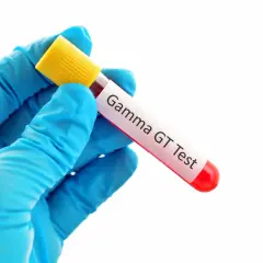 Ręka w niebieskiej rękawiczce trzyma probówkę z krwią do badania Gamma GT.