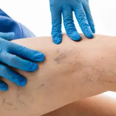 Chirurg naczyniowy: objawy, choroby, leczenie i diagnostyka