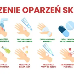 Oparzenie: Złagodź ból! Pierwsza pomoc i czego nigdy nie rób