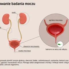 Ilustracja układu moczowego z nerkami, moczowodami i pęcherzem. Pokazuje bakterie przy ujściu cewki moczowej, co jest istotne przy posiewie moczu.