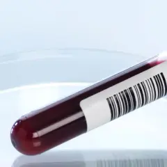 Badanie ANCA: Co to jest? Zrozum wyniki i choroby autoimmunologiczne.