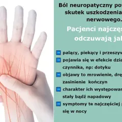 Dłoń z zaznaczonymi czerwonymi liniami nerwowymi, symbolizującymi ból neuropatyczny. Opis objawów: palenie, pieczenie, mrowienie, drętwienie.