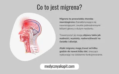 Przedstawienie anatomiczne głowy z zaznaczonym pulsującym bólem głowy na górze, opisujące migrenę jako chorobę neurologiczną.