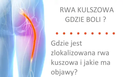 Ból kręgosłupa lędźwiowego promieniujący do nóg, czyli rwa kulszowa. Dowiedz się, gdzie boli i jakie są objawy.