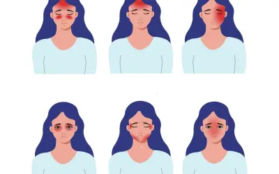 Ilustracje przedstawiają kobiety z różnymi lokalizacjami bólu głowy, w tym z bólem głowy z lewej strony.