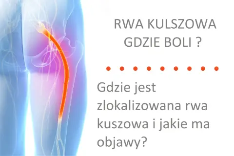 Ból kręgosłupa lędźwiowego promieniujący do nóg, czyli rwa kulszowa. Dowiedz się, gdzie boli i jakie są objawy.