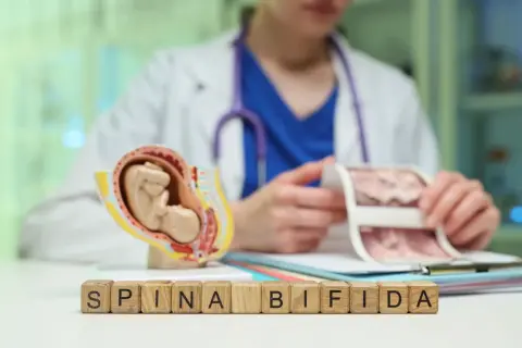 Model płodu i kostki z napisem "SPINA BIFIDA" symbolizują wady rozwojowe kręgosłupa.
