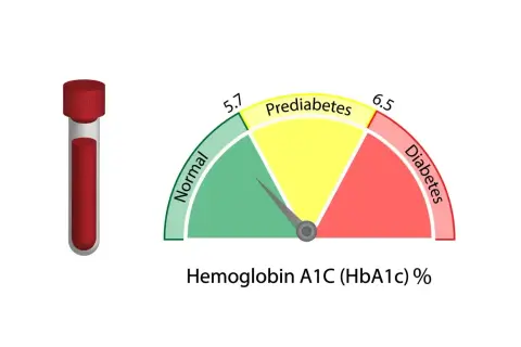 Wskaźnik HBA1C co to za badanie: probówka krwi i wykres pokazujący normę, stan przedcukrzycowy i cukrzycę.