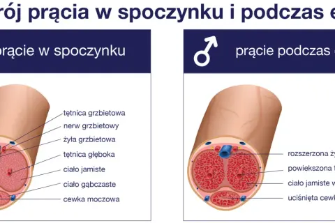 Zaburzenia erekcji: diagnostyka krok po kroku co musisz wiedzieć?