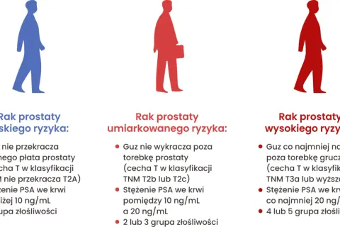 Badanie prostaty: na czym polega? Rozwiewamy mity i obawy