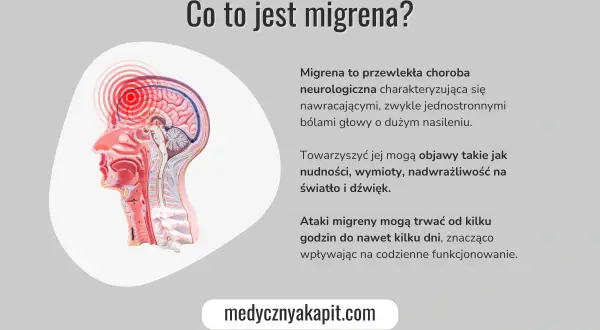 Przedstawienie anatomiczne głowy z zaznaczonym pulsującym bólem głowy na górze, opisujące migrenę jako chorobę neurologiczną.
