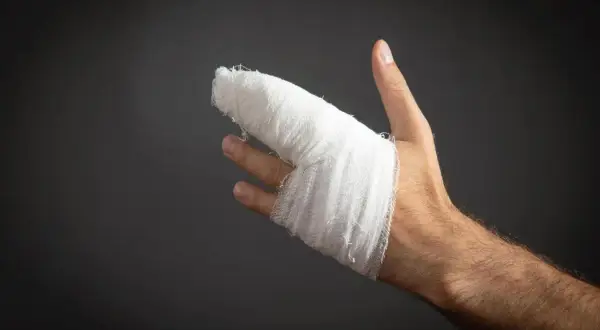 Dłoń z zabandażowanym palcem po urazie. Wygląda na to, że to był wybity palec, który wymagał opatrunku.