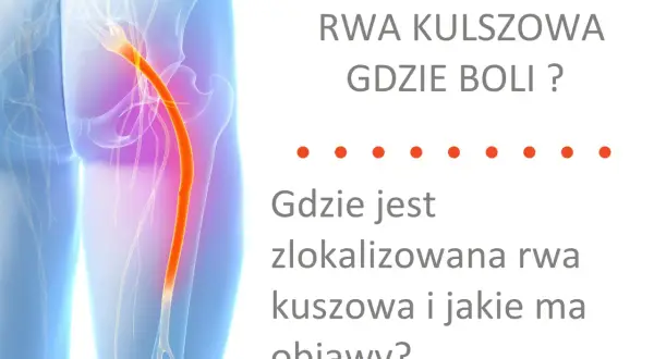 Ból kręgosłupa lędźwiowego promieniujący do nóg, czyli rwa kulszowa. Dowiedz się, gdzie boli i jakie są objawy.
