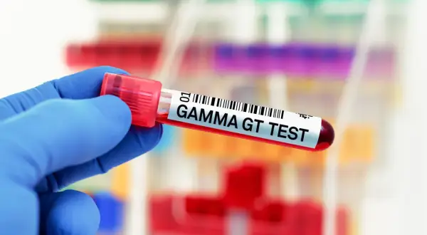 Rękawiczka w niebieskiej rękawiczce trzyma probówkę z napisem "GAMMA GT TEST". W tle widać inne probówki z próbkami.
