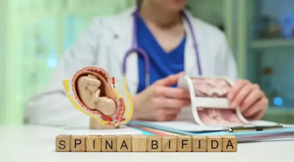 Model płodu i kostki z napisem "SPINA BIFIDA" symbolizują wady rozwojowe kręgosłupa.