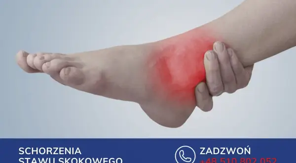 Ból w okolicy stawu skokowego, gdzie znajduje się kość strzałkowa. Czerwony obszar wskazuje na stan zapalny.