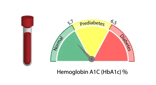 Wskaźnik HBA1C co to za badanie: probówka krwi i wykres pokazujący normę, stan przedcukrzycowy i cukrzycę.