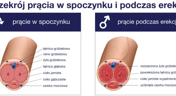 Zaburzenia erekcji: diagnostyka krok po kroku co musisz wiedzieć?
