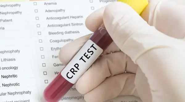 Badanie CRP: Zrozum swoje wyniki. Co oznacza podwyższone CRP?