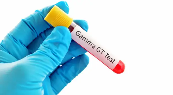 Ręka w niebieskiej rękawiczce trzyma probówkę z krwią do badania Gamma GT.