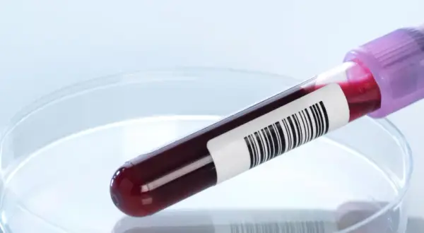 Badanie ANCA: Co to jest? Zrozum wyniki i choroby autoimmunologiczne.
