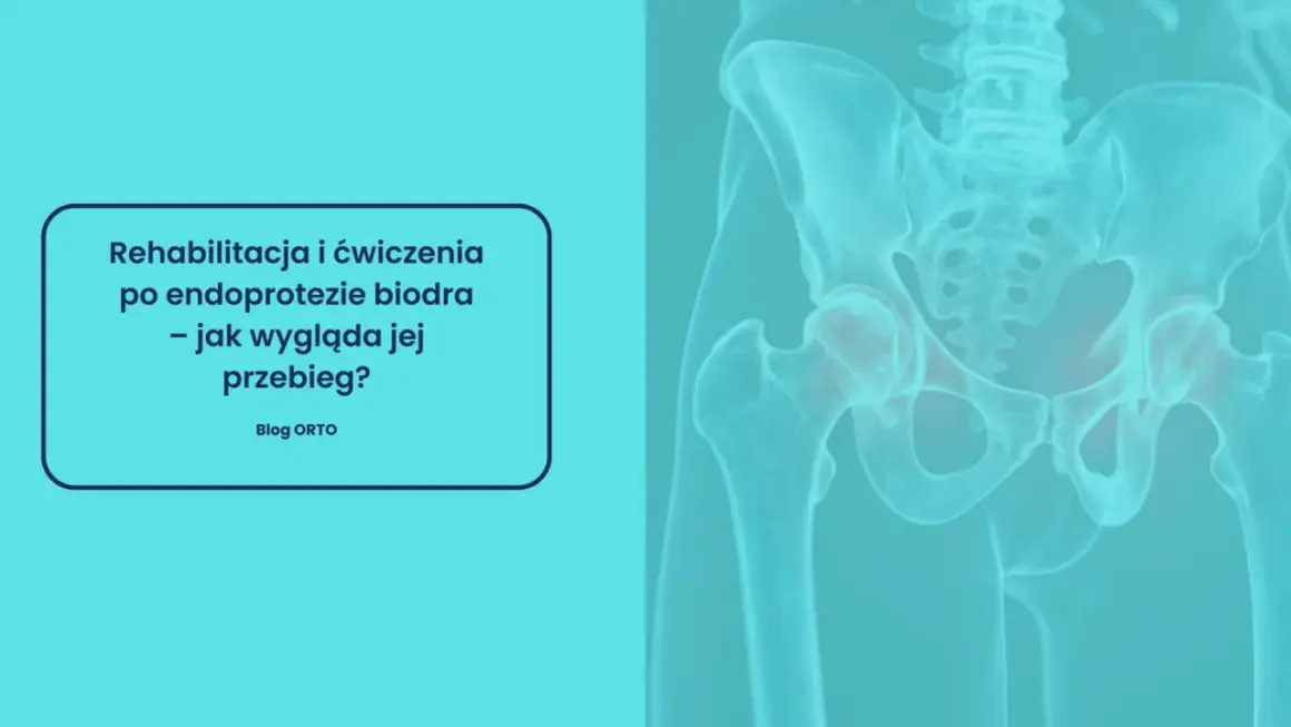 Rehabilitacja poszpitalna po endoprotezie biodra NFZ. Grafika przedstawia miednicę z zaznaczonymi stawami biodrowymi.