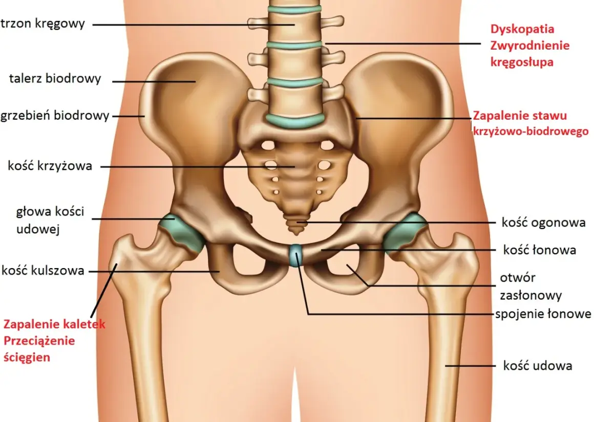 Anatomia miednicy z zaznaczonymi strukturami, które mogą powodować ból stawów, np. zapalenie kaletek, przeciążenie ścięgien, zapalenie stawu krzyżowo-biodrowego.