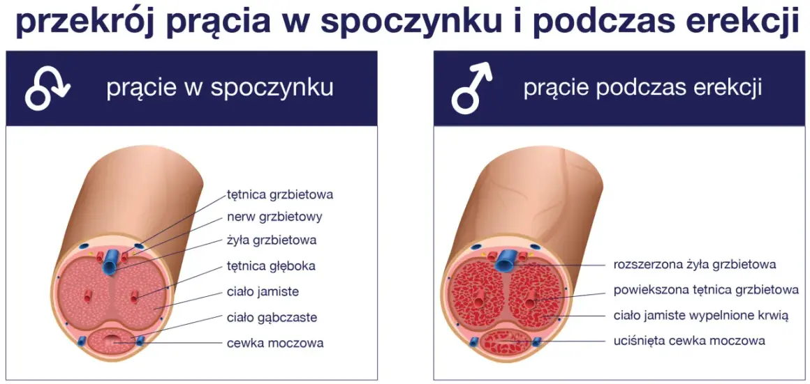 Zaburzenia erekcji: diagnostyka krok po kroku co musisz wiedzieć?