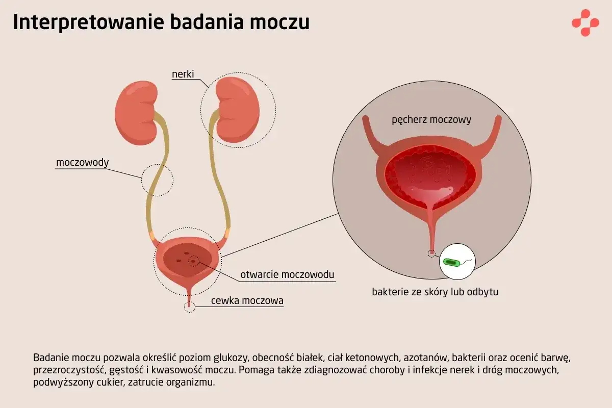 Ilustracja układu moczowego z nerkami, moczowodami i pęcherzem. Pokazuje bakterie przy ujściu cewki, co jest istotne przy posiewie moczu.