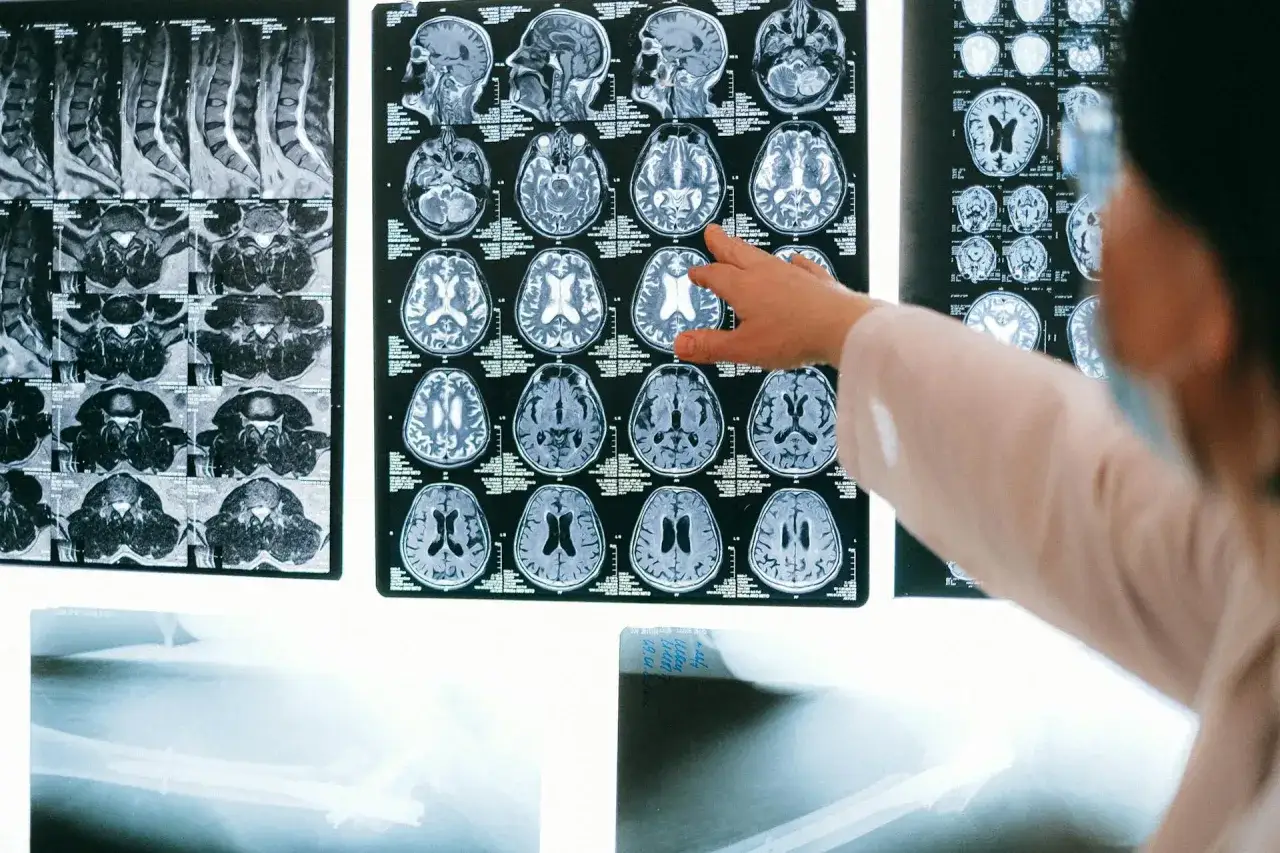 Lekarz analizuje tomografię i rezonans mózgu oraz kręgosłupa, porównując obrazy.