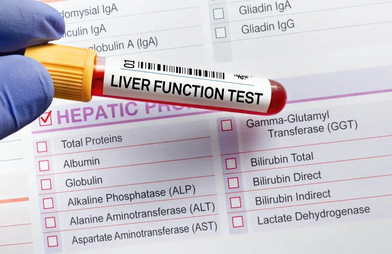 Wynik badania wątroby, z zaznaczonym polem Gamma-Glutamyl Transferase (GGT), sugerującym podwyższone ggtp.