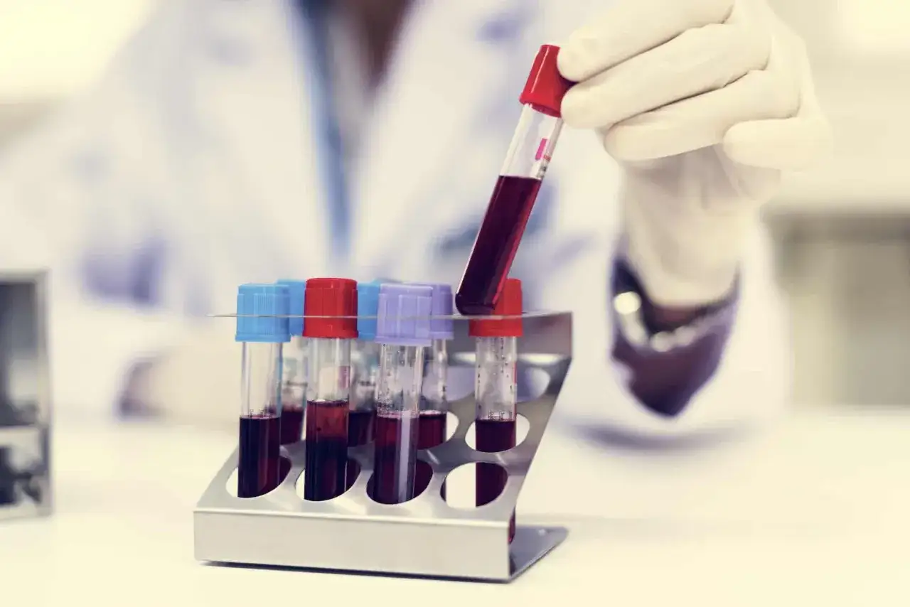 Ręka w rękawiczce laboratoryjnej trzyma probówkę z krwią do analizy morfologii.