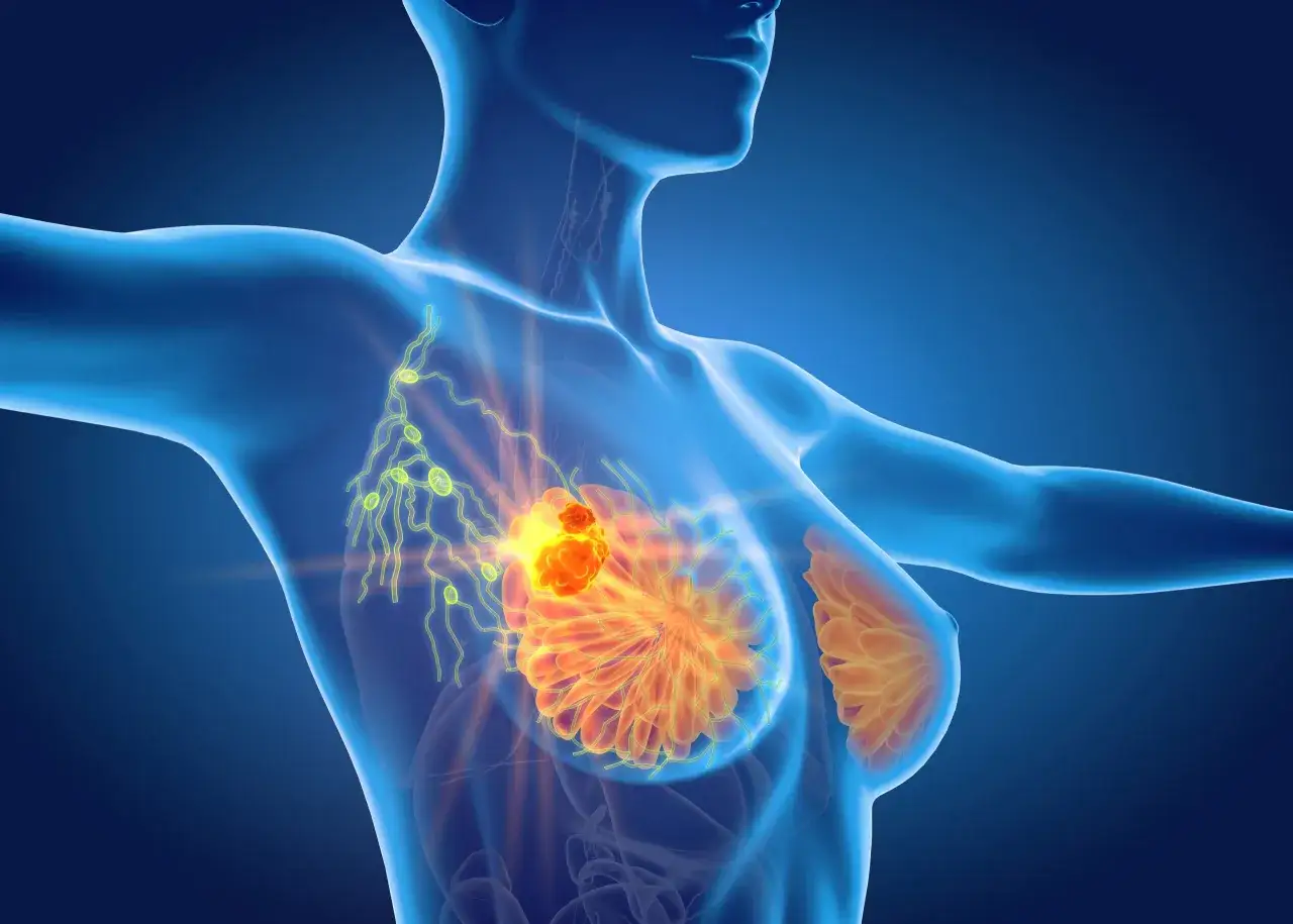 Anatomia piersi z widocznym guzem i węzłami chłonnymi. Ból pod pachą może być objawem.