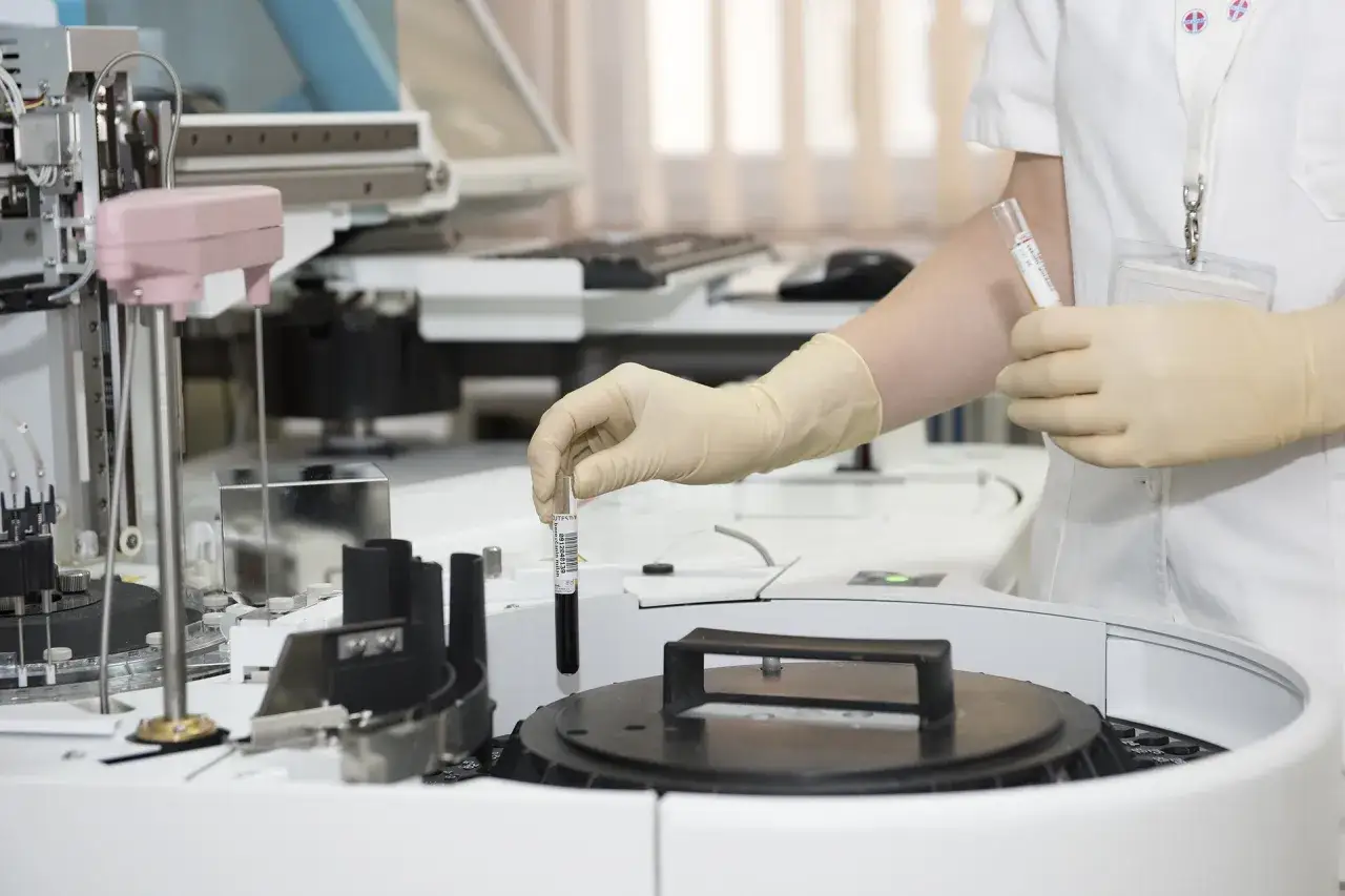 Rękawiczka laboratorium trzyma probówkę z ciemnym płynem. To część badania ALT, co to jest?