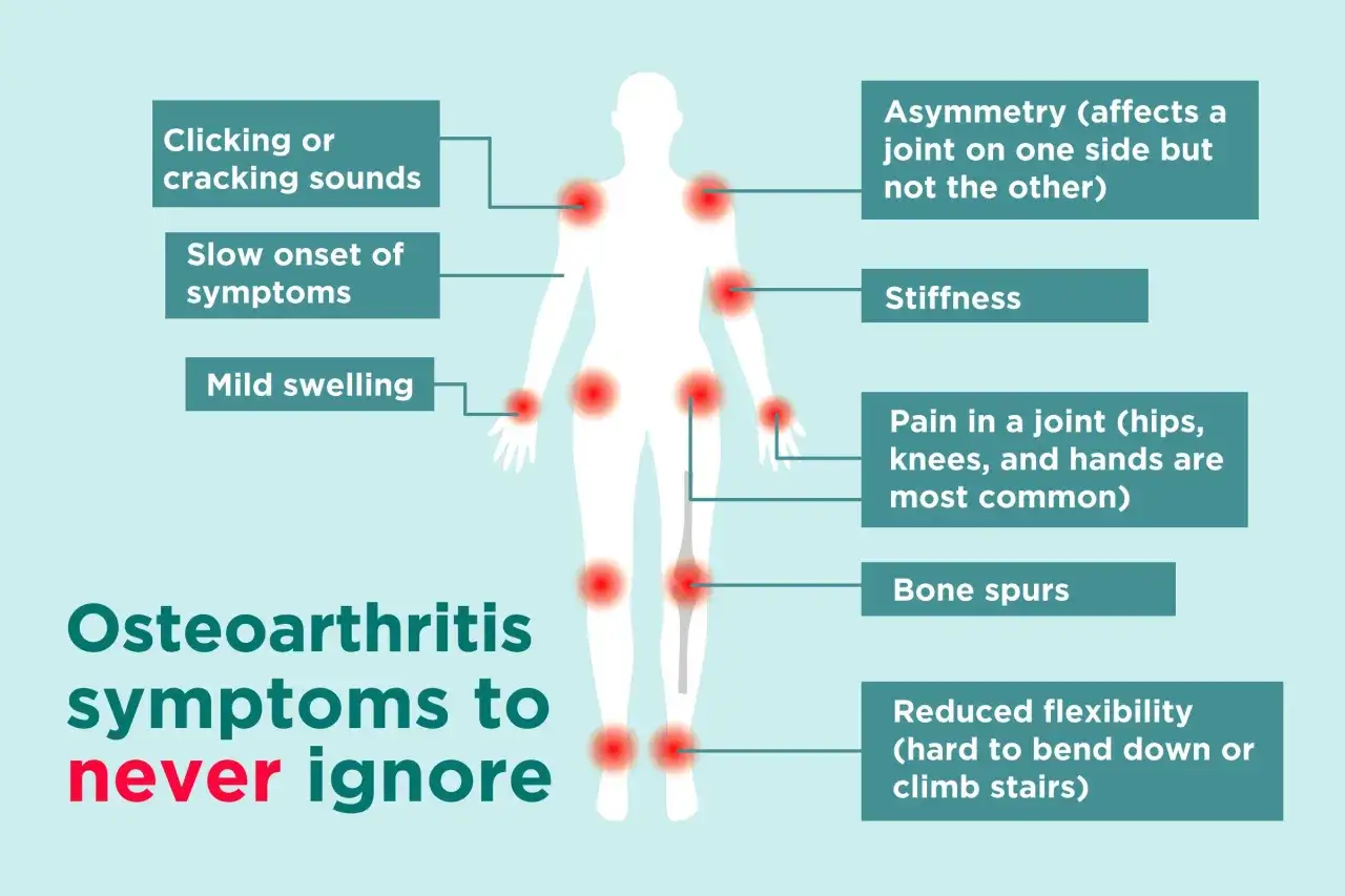 Schemat ukazuje objawy osteoartrozy: ból stawów, sztywność, obrzęk, trzaski, asymetrię, ostrogi kostne i zmniejszoną elastyczność.