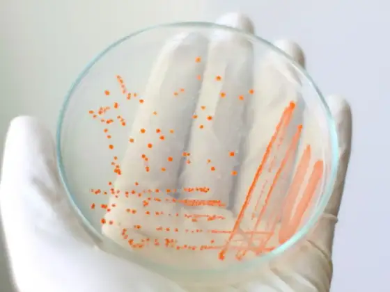 Test oddechowy Helicobacter pylori - kiedy warto go zrobić?
