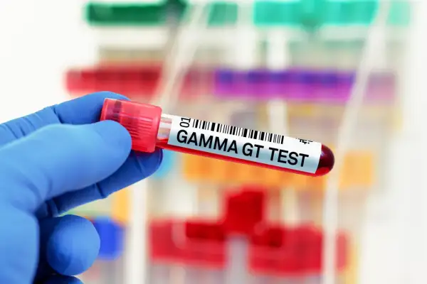 Rękawiczka w niebieskiej rękawiczce trzyma probówkę z napisem "GAMMA GT TEST". W tle widać inne probówki z próbkami.