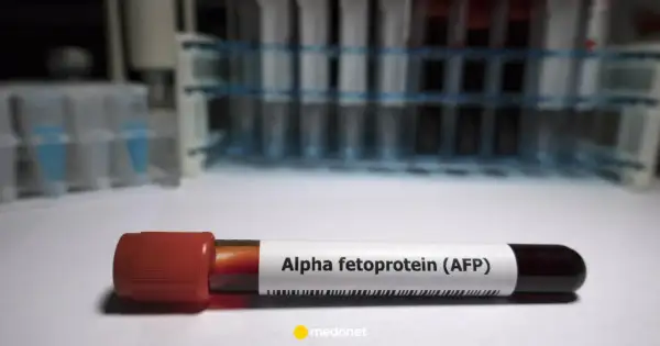 Probówka z krwią oznaczona jako "Alpha fetoprotein (AFP)". W tle stojaki z innymi próbkami.